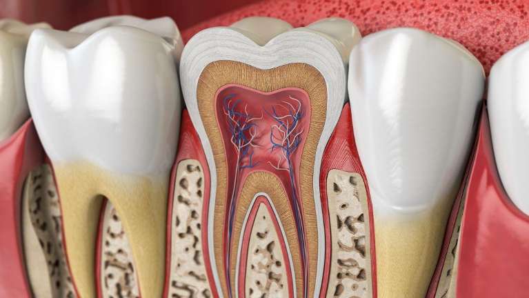 Root canal in Havertown